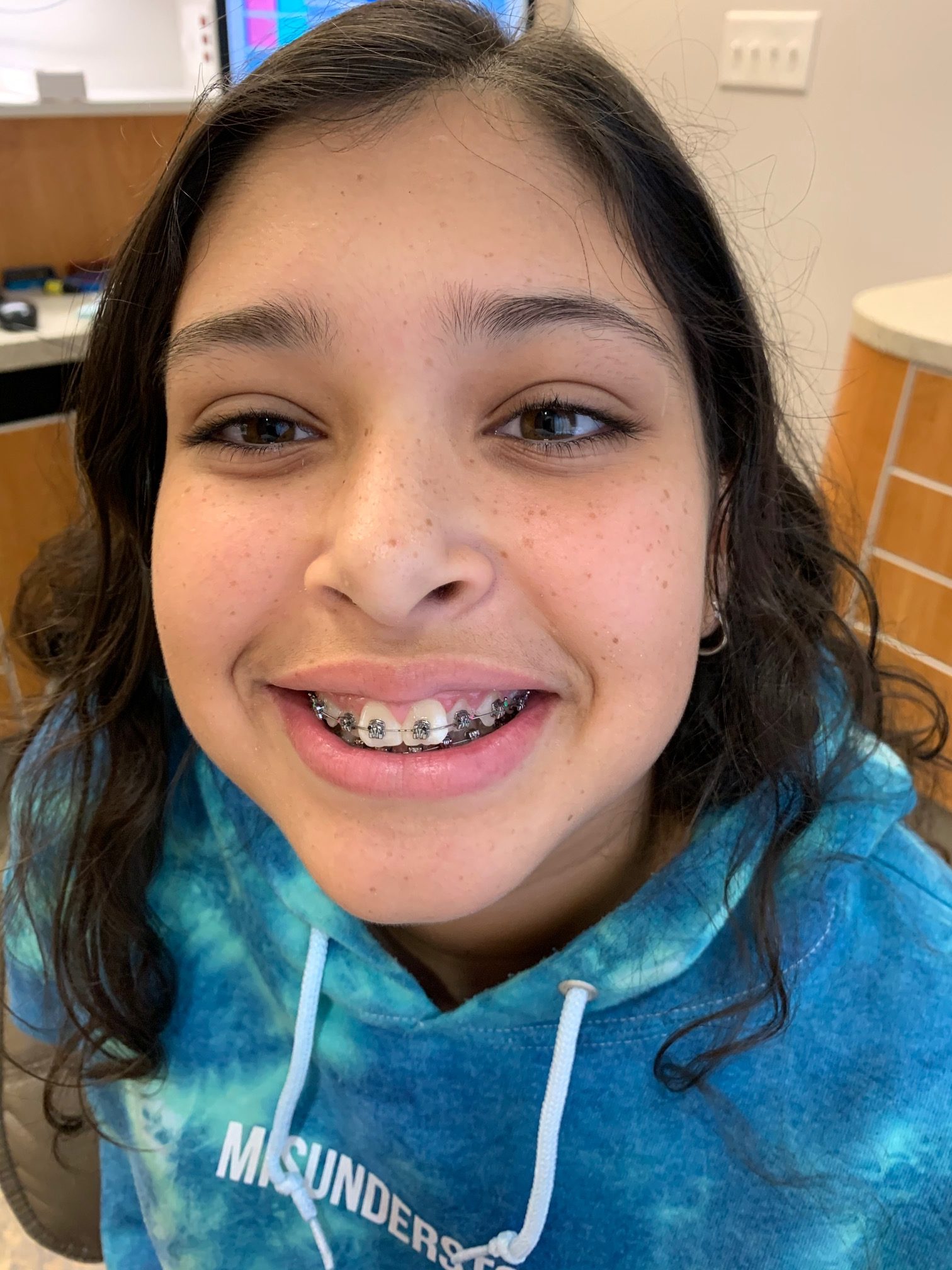 How Much Do Braces Cost Find Affordable Braces At Kool Smiles 